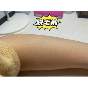 呼和浩特京美整形美容医院好不好-推荐熊师医生，陈喆医生，郝维亮医生