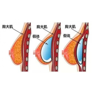南京伊美辰医疗美容做自体脂肪丰鼻基底多少钱？专家介绍、案例分享、价格参考