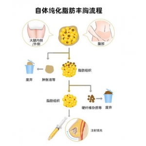 北京延世医疗美容是正规机构吗？解析韩式自然风鼻祖的资质+医生天团+真实口碑！