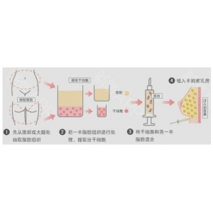 沈阳祛眼袋医院哪家强？这5家专业机构医生技术大公开